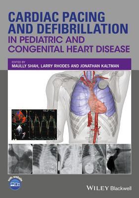 Full Download Cardiac Pacing and Defibrillation in Pediatric and Congenital Heart Disease - Maully Shah file in ePub