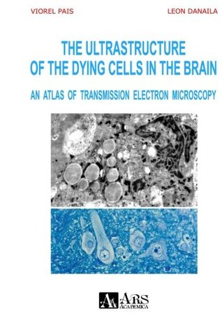 Read The Ultrastructure of the Dying Cells in the Brain. An Atlas of Transmission Electron Microscopy - Viorel Pais file in ePub