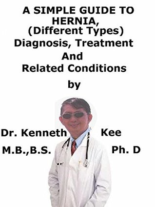 Download A Simple Guide To Hernia, (Different Types) Diagnosis, Treatment And Related Conditions - Kenneth Kee file in PDF